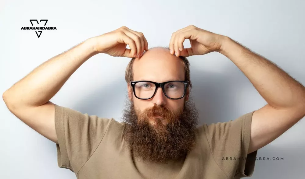 What exactly is the process of hair loss?